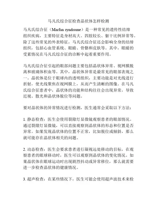 马凡氏综合征检查晶状体怎样检测