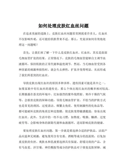 如何处理皮肤红血丝问题