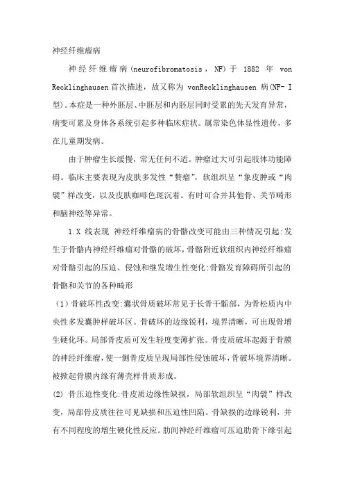 神经纤维瘤病影像表现
