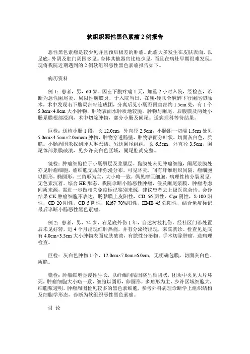 软组织恶性黑色素瘤2例报告