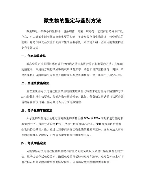 微生物的鉴定与鉴别方法