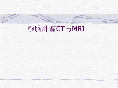 脑肿瘤经典影像 ppt课件