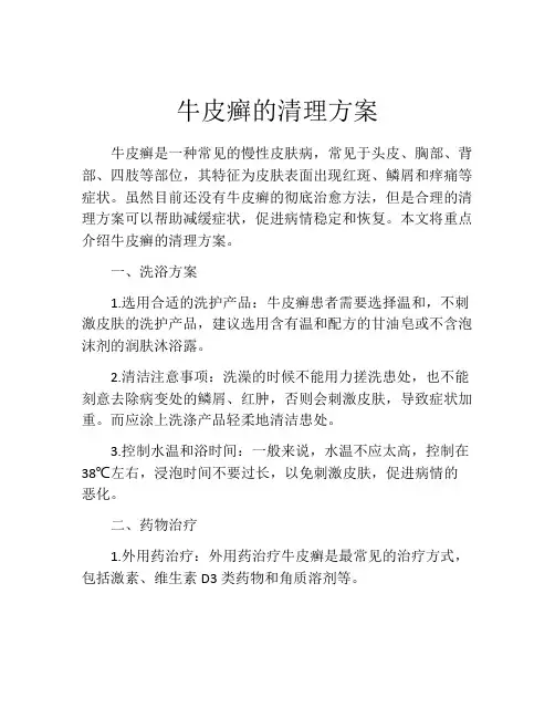 牛皮癣的清理方案