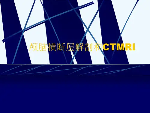颅脑横断层解剖和CTMRI[可修改版ppt]