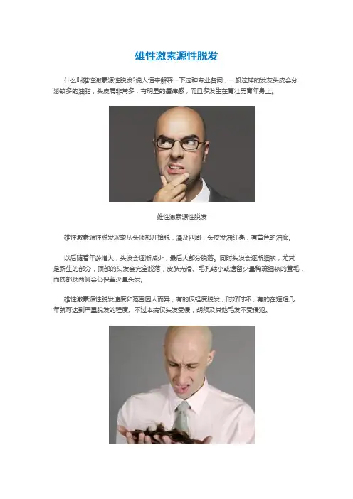 雄性激素源性脱发
