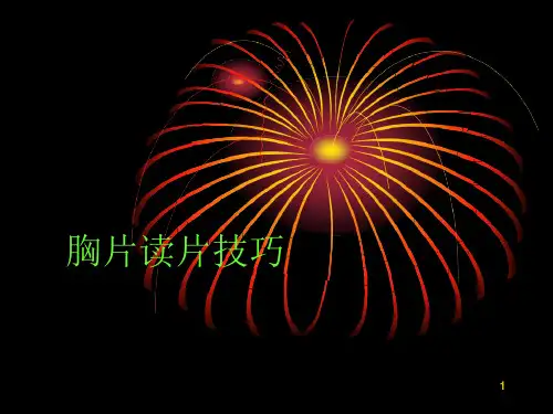 胸片和ct读片技巧初级篇影像课件