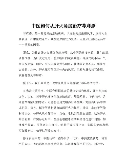 中医如何从肝火角度治疗荨麻疹