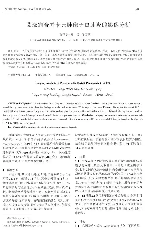 艾滋病合并卡氏肺孢子虫肺炎的影像分析