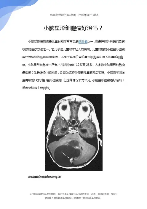 小脑星形细胞瘤好治吗？