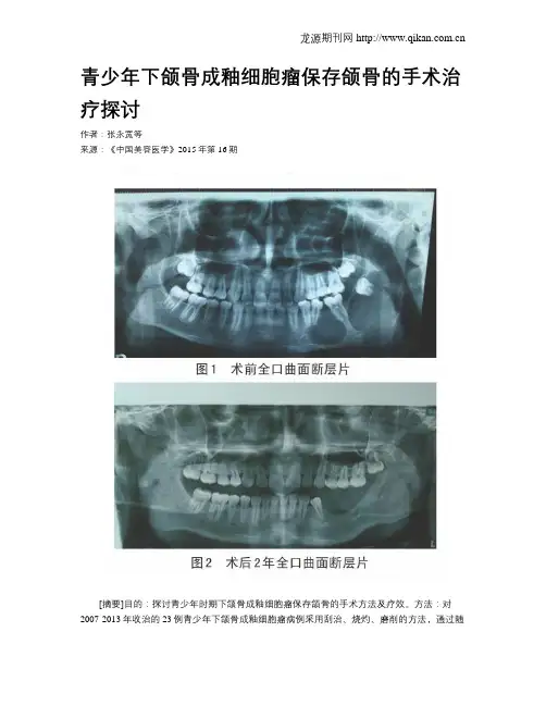 青少年下颌骨成釉细胞瘤保存颌骨的手术治疗探讨