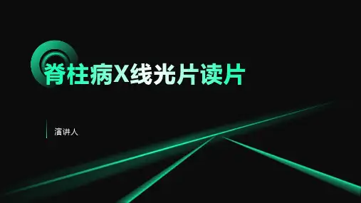 脊柱病X线光片读片