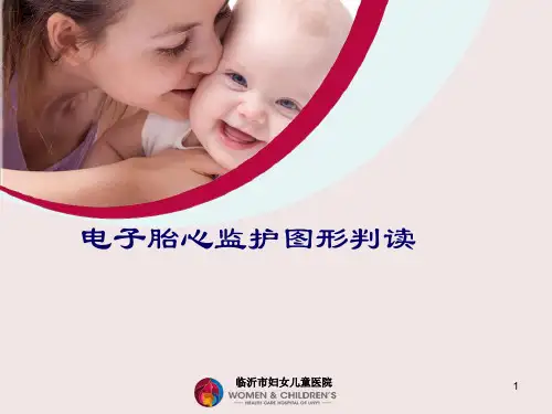 胎心监护图形判读PPT课件