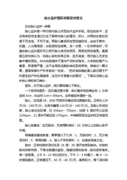 胎心监护图形讲解及其意义
