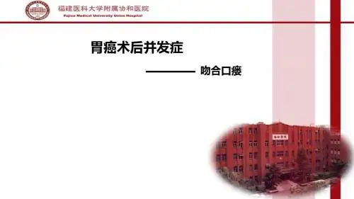 胃癌术后并发症-吻合口瘘