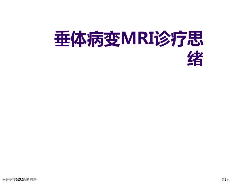 垂体病变MRI诊断思路
