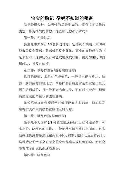 宝宝的胎记 孕妈不知道的秘密