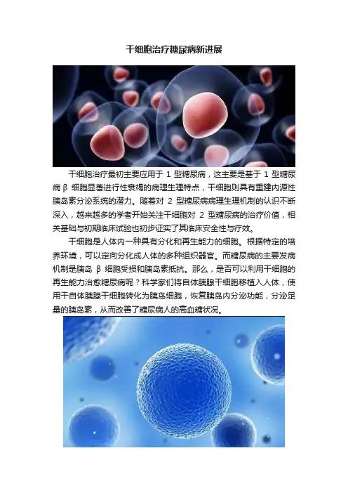 干细胞治疗糖尿病新进展