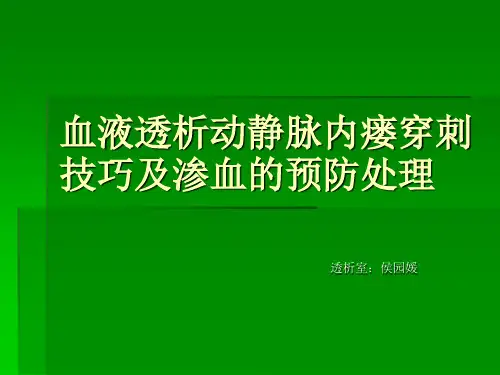 血液透析内瘘穿刺技巧