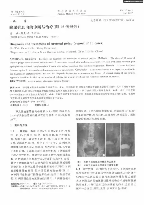 输尿管息肉的诊断与治疗(附16例报告)