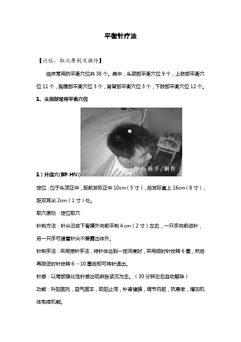 平衡针疗法附穴位图 (1)