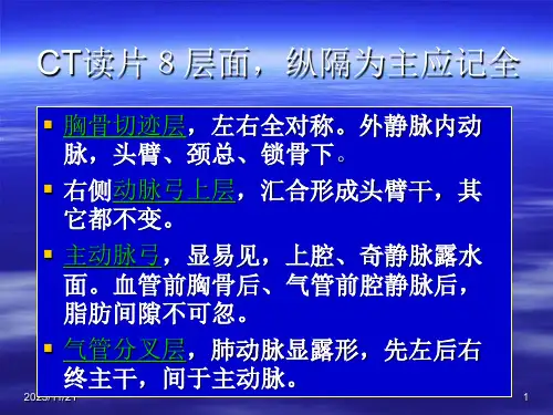 CT读片胸部PPT课件