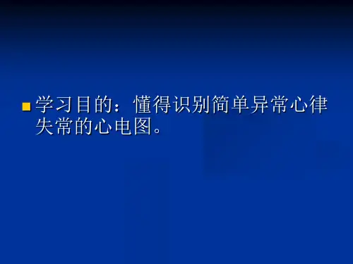 最新心律失常的心电图PPT课件