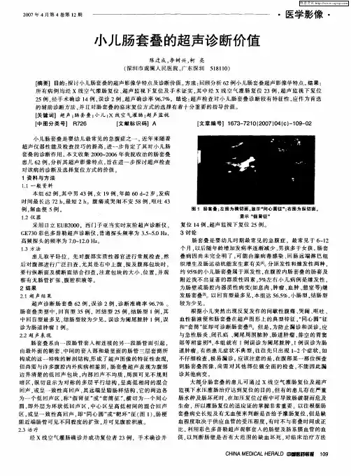 小儿肠套叠的超声诊断价值