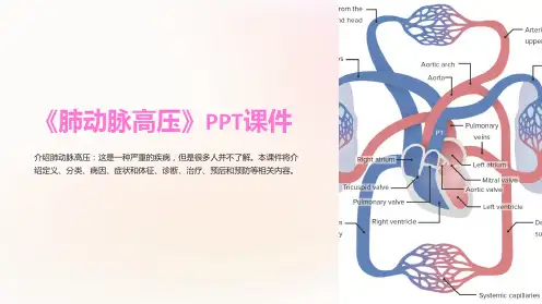 《肺动脉高压》课件