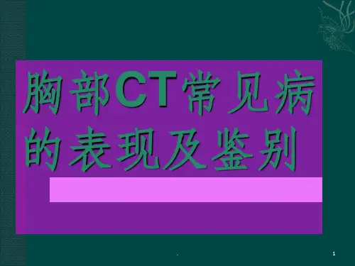 胸部CT常见病