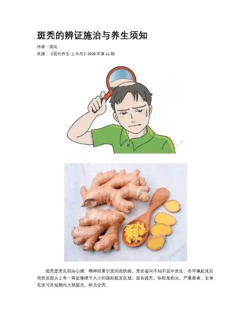 斑秃的辨证施治与养生须知