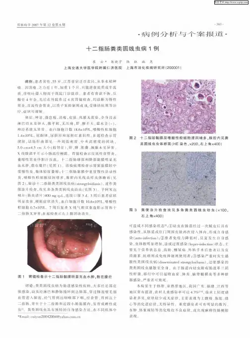 十二指肠粪类圆线虫病1例