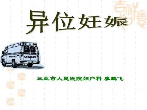 异位妊娠