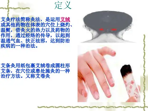 艾条灸法ppt课件