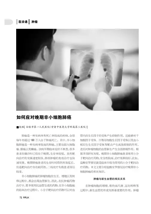 如何应对晚期非小细胞肺癌