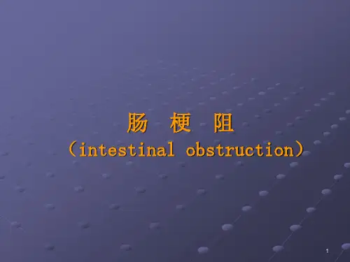肠梗阻的诊断和治疗