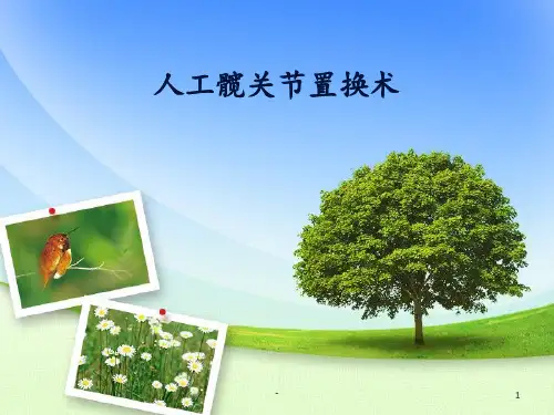 人工全髋关节置