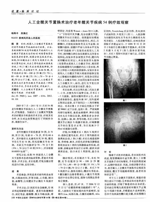 人工全髋关节置换术治疗老年髋关节疾病54例疗效观察