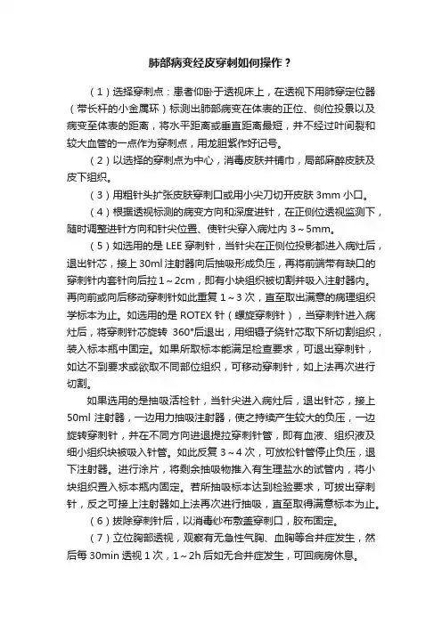 肺部病变经皮穿刺如何操作？