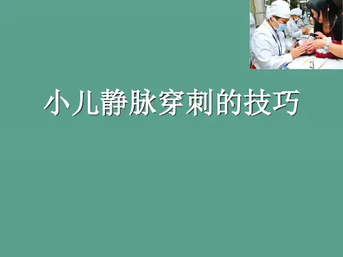 小儿静脉穿刺的技巧ppt课件