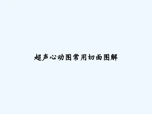 超声心动图常用切面图解 PPT