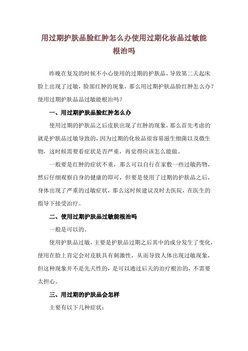 用过期护肤品脸红肿怎么办 使用过期化妆品过敏能根治吗