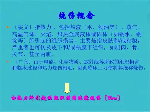 烧伤急救措施与创面处理(共91张PPT)