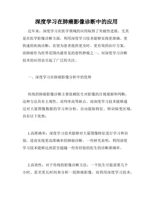 深度学习在肺癌影像诊断中的应用