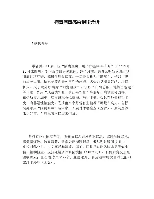 梅毒病毒感染误诊分析