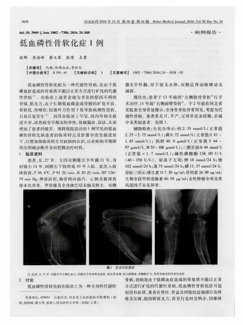 低血磷性骨软化症1例
