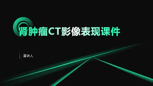 肾肿瘤CT影像表现课件