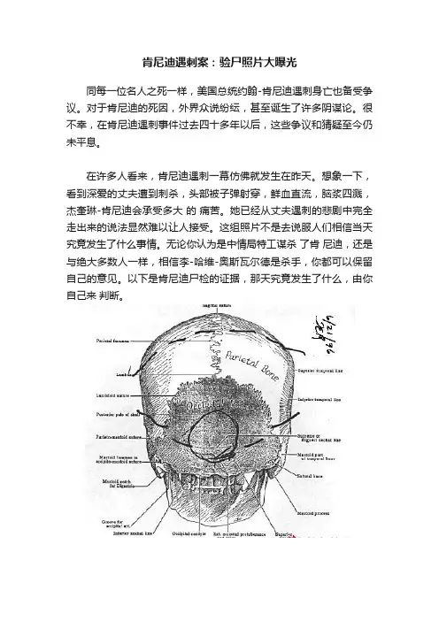 肯尼迪遇刺案：验尸照片大曝光