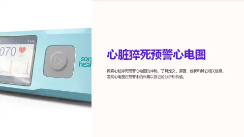 心脏猝死预警心电图