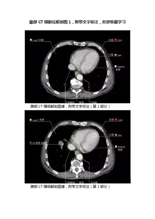 腹部CT横断位解剖图1，附带文字标注，欢迎收藏学习
