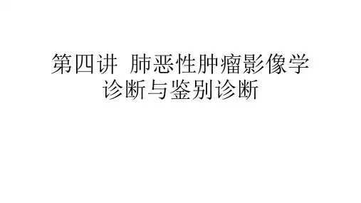 【影像 诊断 课件 幻灯】(3.4.1)--肺恶性肿瘤的影像诊断与鉴别诊断